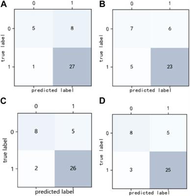 Establishment and interpretation of the gamma pass rate prediction model based on radiomics for different intensity-modulated radiotherapy techniques in the pelvis